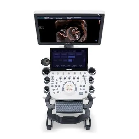 USM aparatı SonoScape P20
