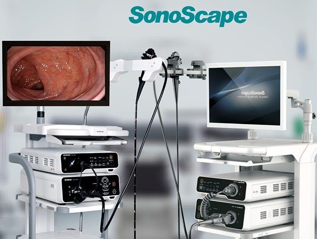 Sonoscape Endoscopy system